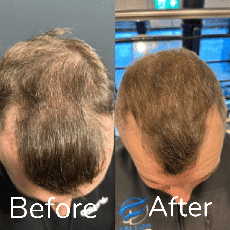 Sean's hair transformation