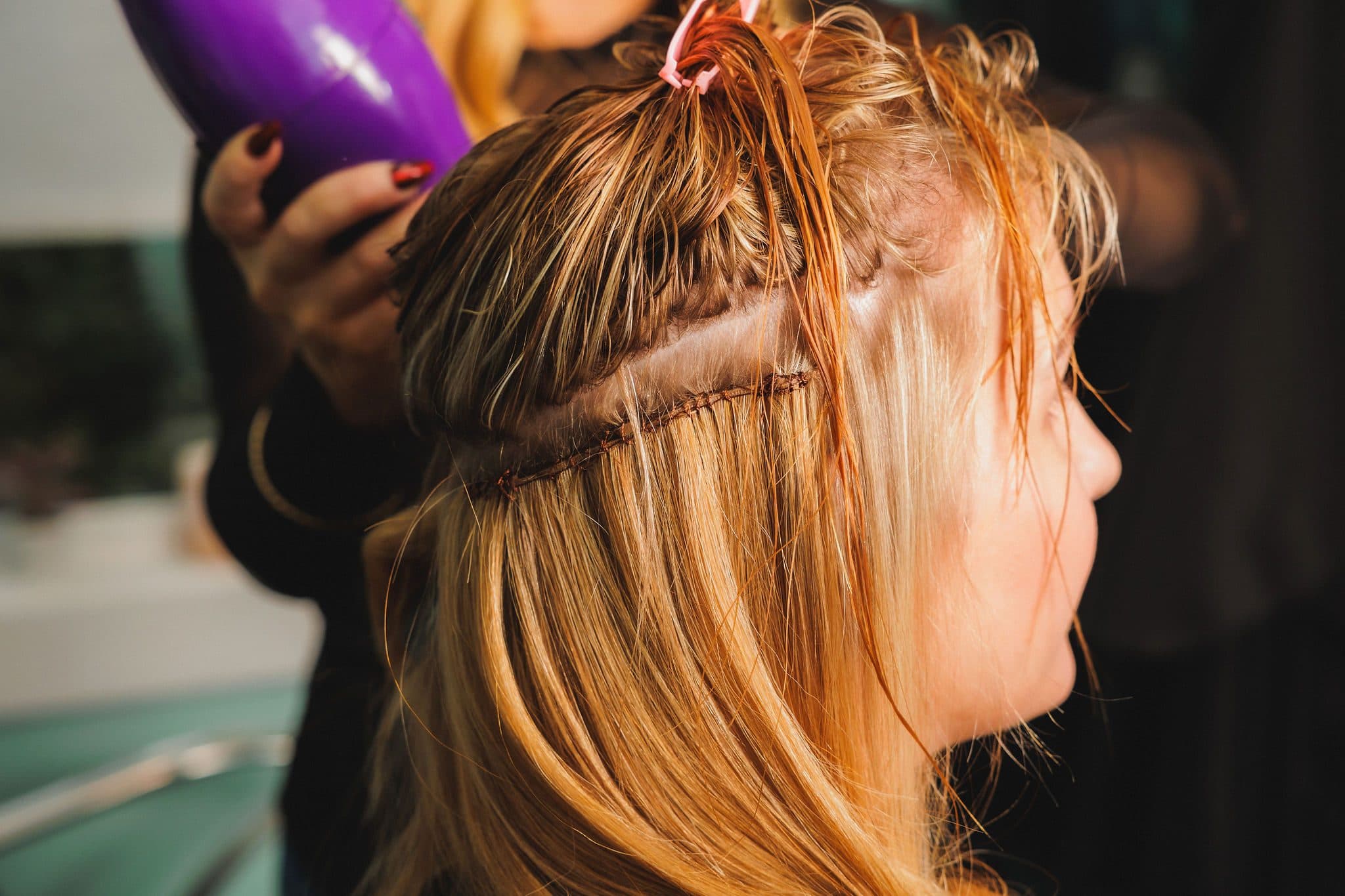 Be-You Hair Clinic Malahide, client result 31