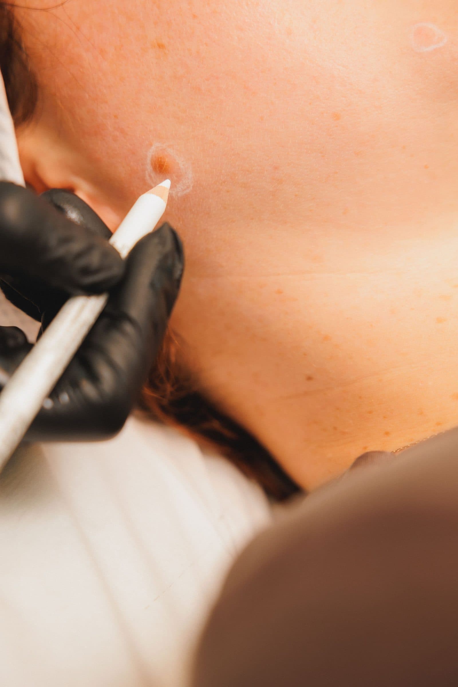 Be-You Hair Clinic Malahide, client result 44