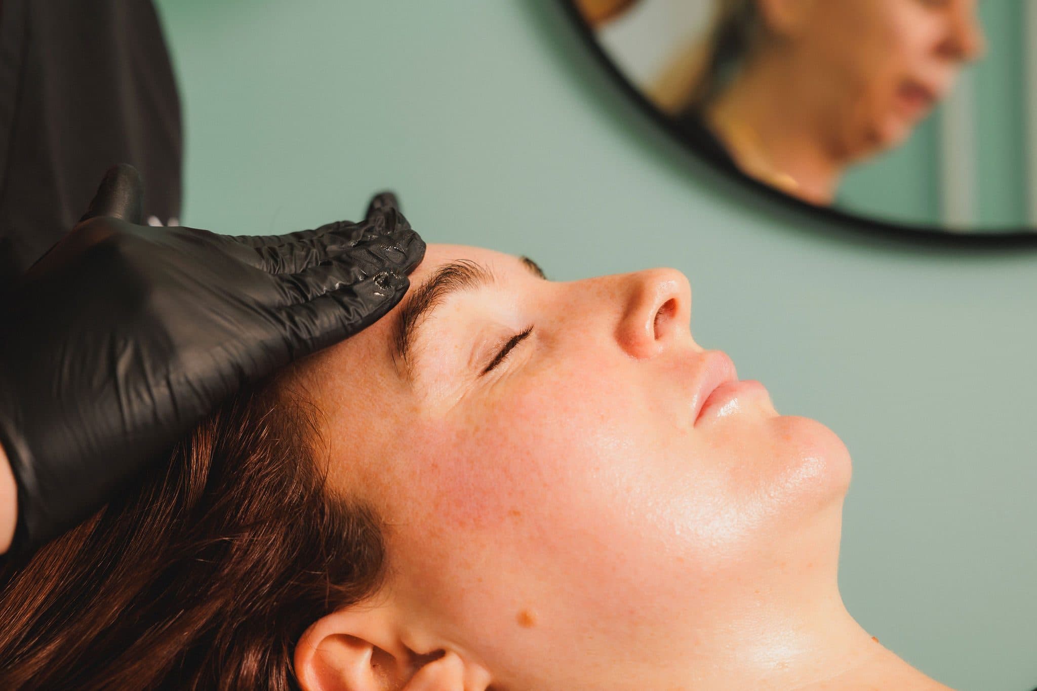 Be-You Hair Clinic Malahide, client result 56