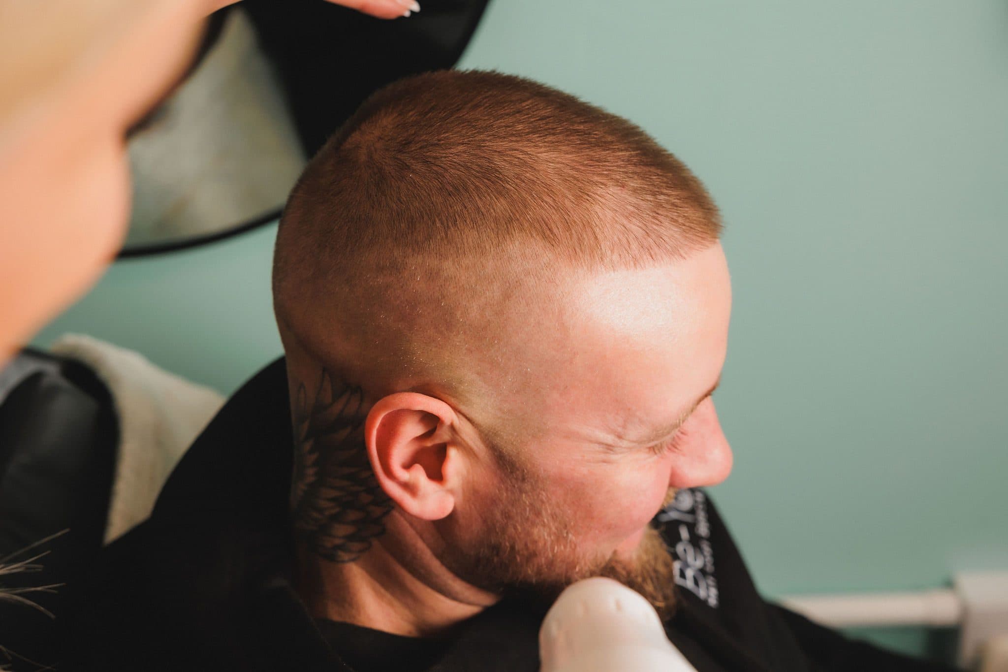 Be-You Hair Clinic Malahide, client result 62