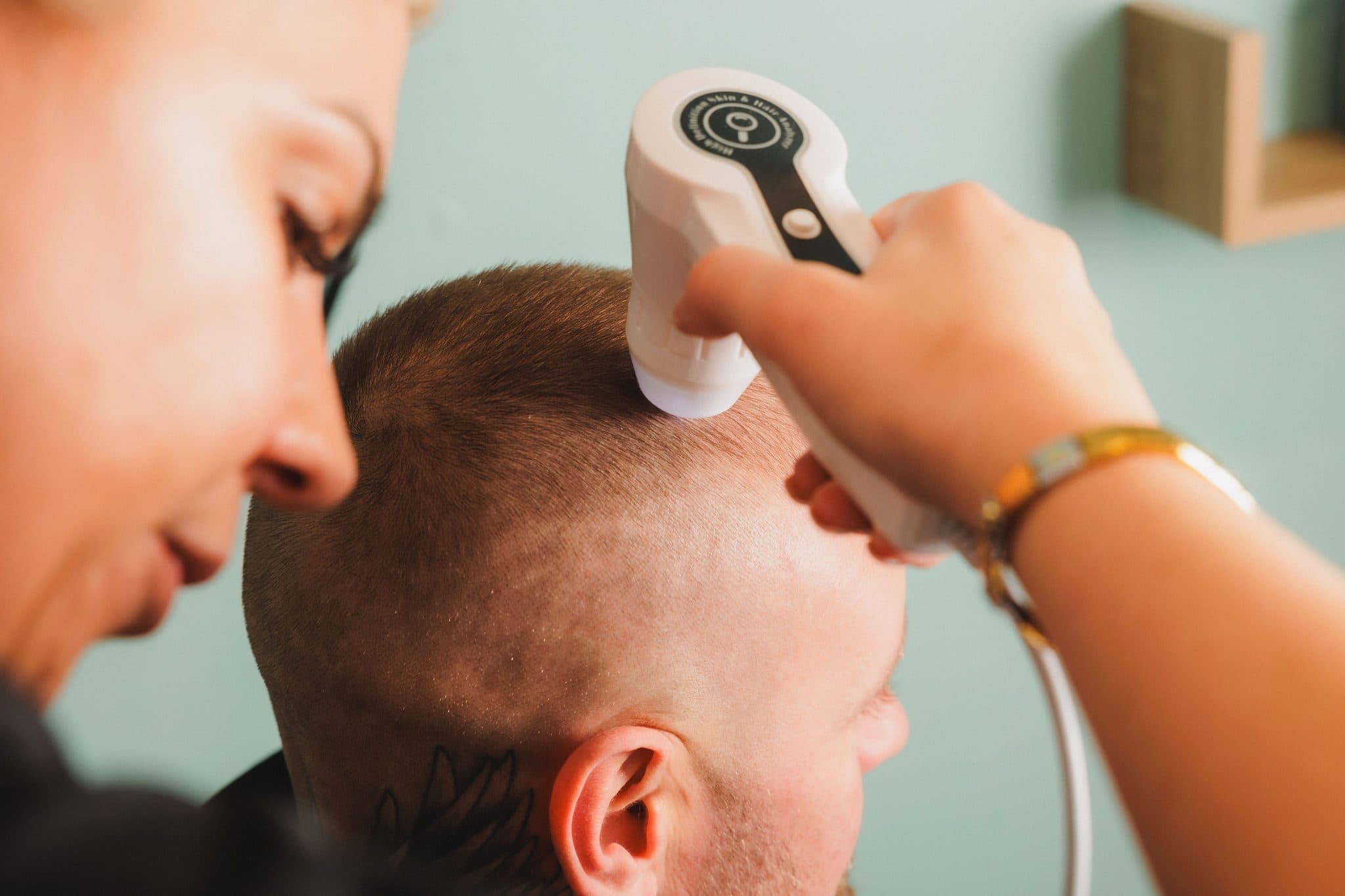 Be-You Hair Clinic Malahide, client result 63