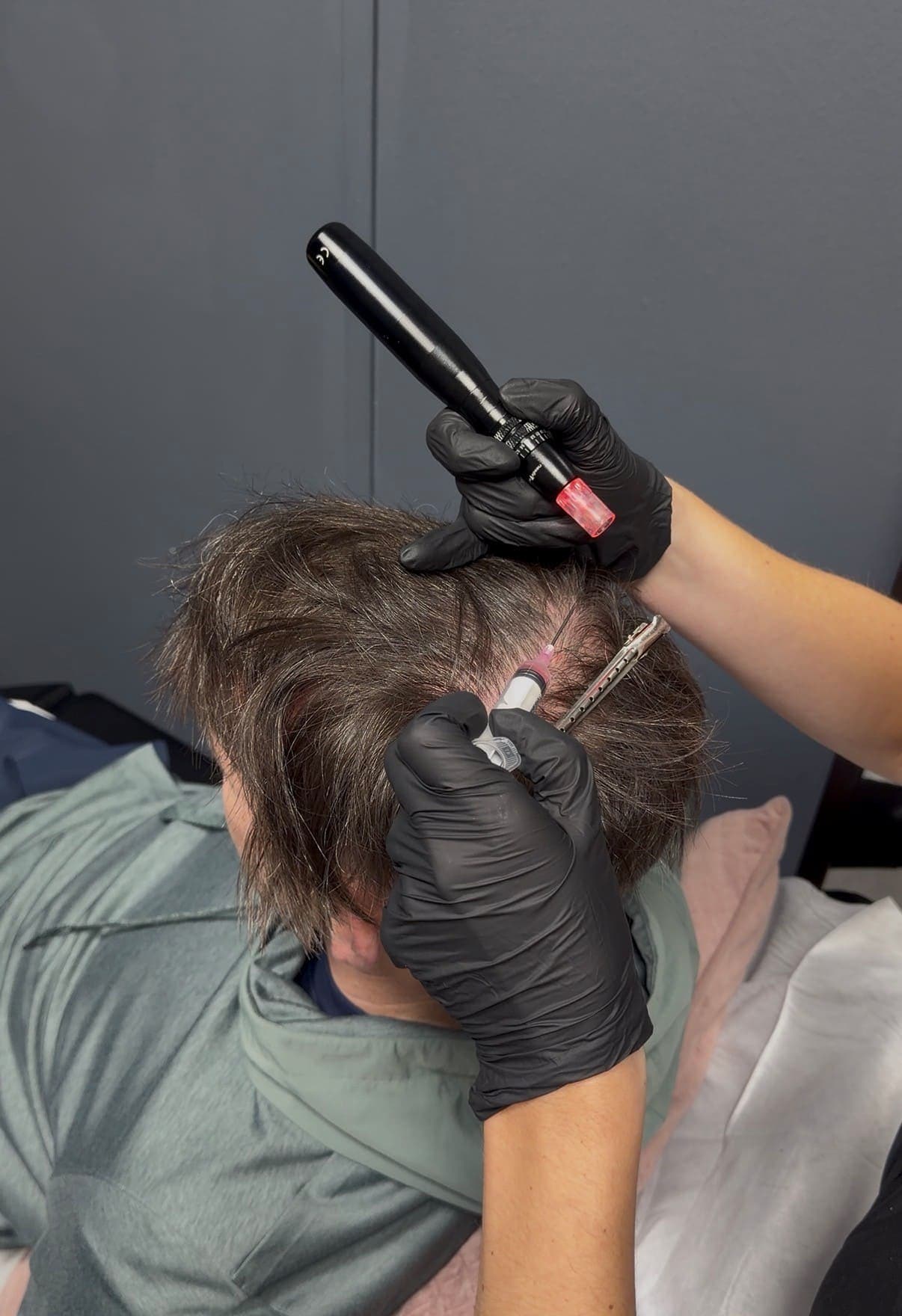 Be-You Hair Clinic Malahide, client result 99