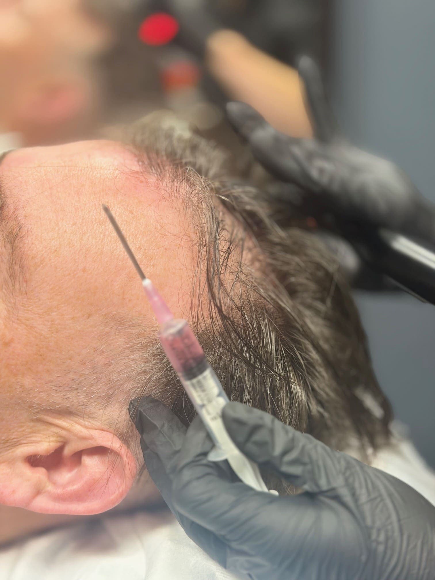 Be-You Hair Clinic Malahide, client result 101